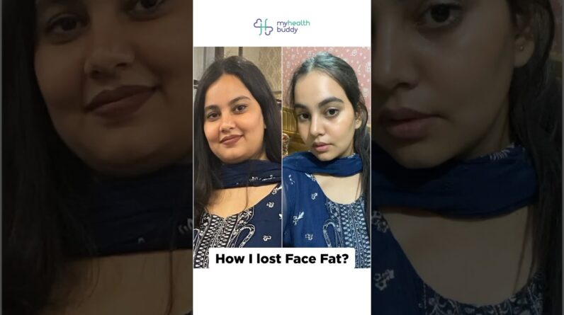 Lost FACE FAT | 9kg weight loss | MyHealthBuddy